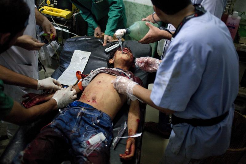 Niño herido Siria