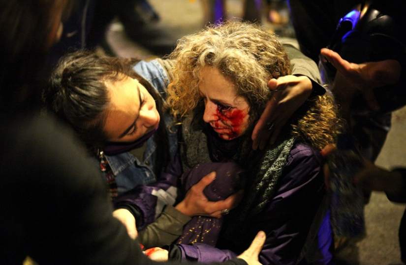 Esther Quintana perdió un ojo durante los incidentes registrados tras la huelga general del 14N en Barcelona. / Efe