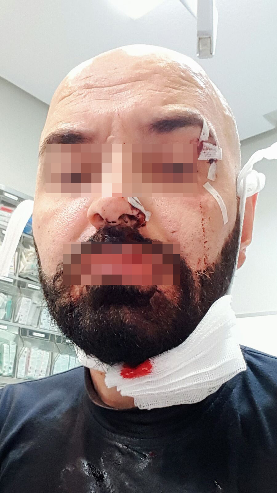 Jorge, con múltiples lesiones en la cara provocadas por el vaso que el agresor le rompió en la cara